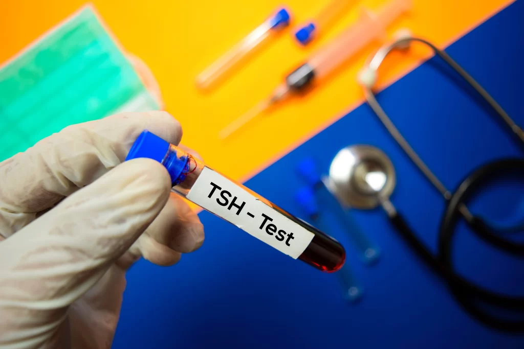 TSH test to help identify and manage hypothyroidism 